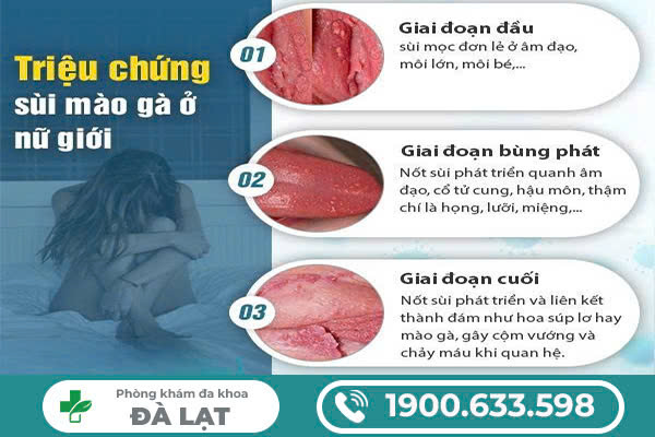 Hình ảnh minh họa